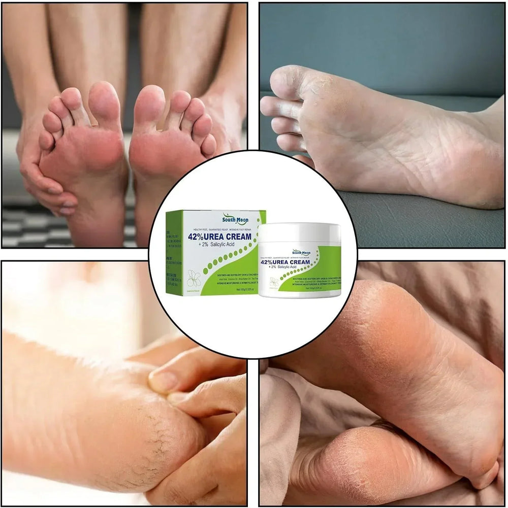 South Moon - 42% Urea Cream + 2% Salicylic Acid (Original) - DesertGoods