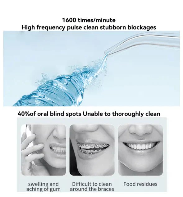 Oral Irrigator – Find Your Beauty - DesertGoods